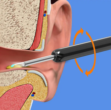 Load image into Gallery viewer, StopCerumen - Nettoyeur d'Oreilles